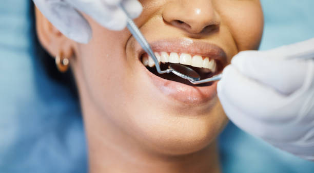 Best Emergency Treatment for Toothache in East Missoula, MT